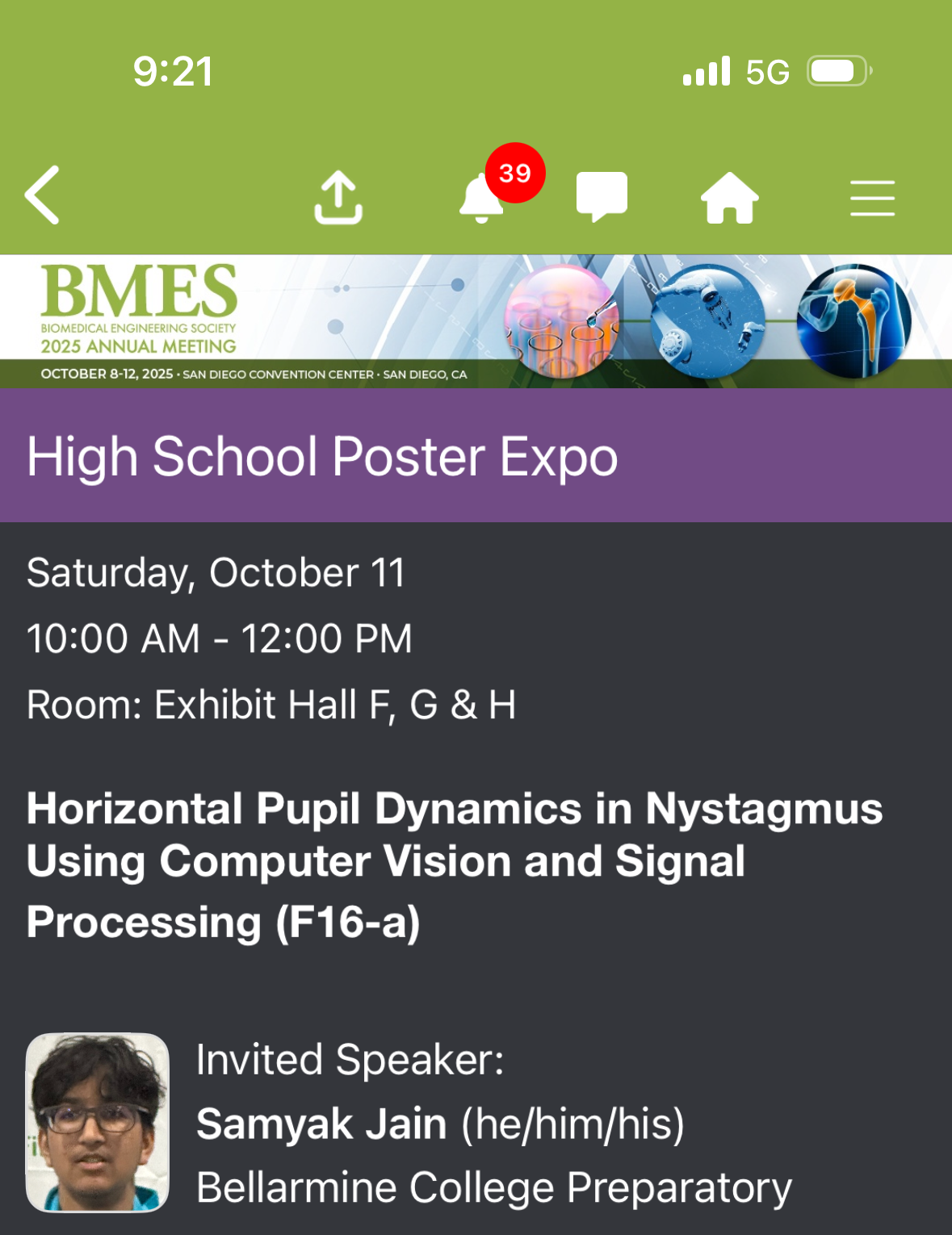 Horizontal Pupil Dynamics in Nystagmus Research Presentation